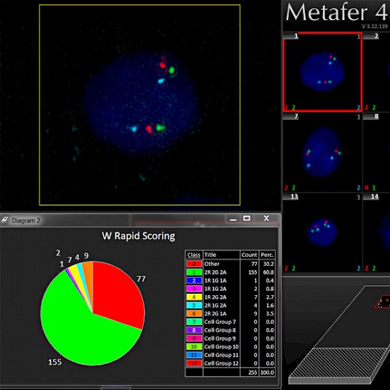Clinical Cancer and Cell Biology MetaSystems