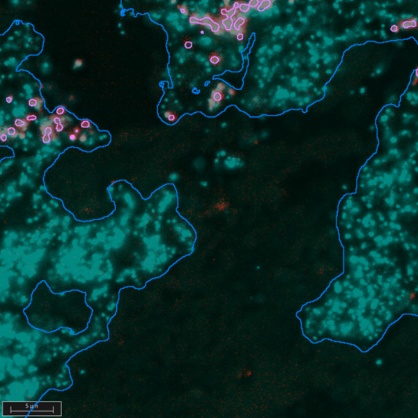 Successful completion of the TEAM research project: New approaches to personalized therapy for severe infections Successful completion of the TEAM research project: New approaches to personalized therapy for severe infections